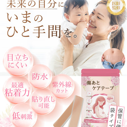 傷あとケアテープ